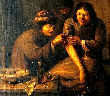 A Surgical Operation of the Arm