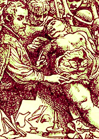 Andreas Vesalis Dissecting a Corpse