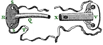 Wound Drains, Dionis