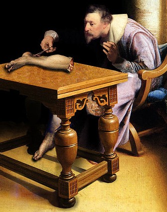 Philippe Verheyen Dissecting His Amputated Limb (1715-1730)