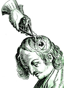 Using Bone Cutters, Scultetus