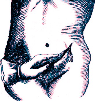 Cutting an Existing Abdominal Wound