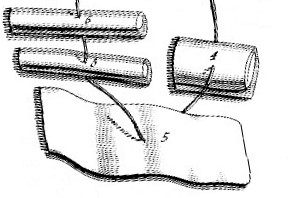 Dressings 4-6 Complex Fracture, Le Clerc