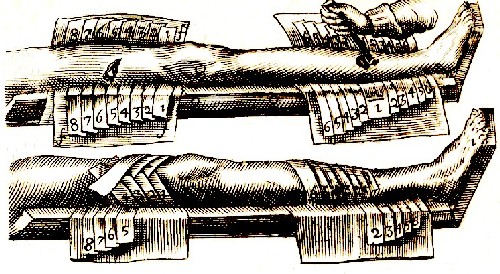 Graduated bandages on a leg Scultetus