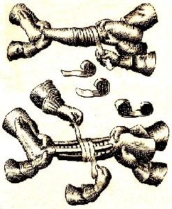 Double and Single Roller Bandaging from Scultetus