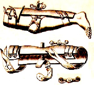 A metal splint Solingen