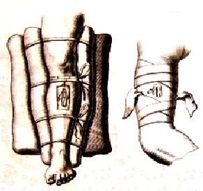 Wound Dressing, Cornelius Solingen