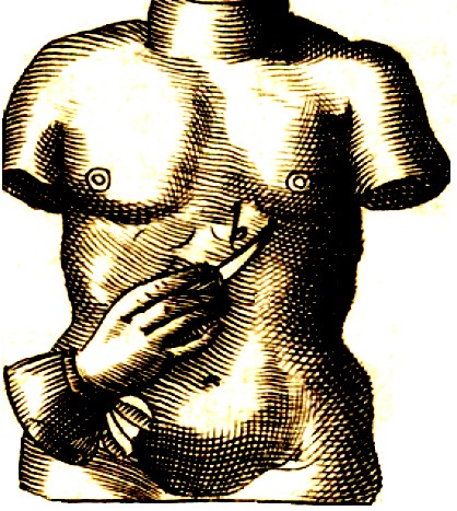 Abdominal surgery Scultetus