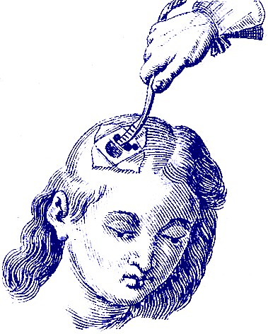 Using an Elevator on the Skull