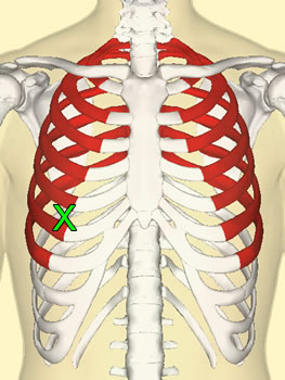 Secondary Incision Empyema Front