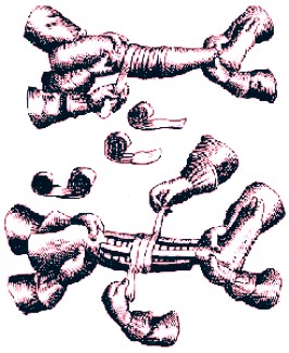 Bandaging Before Laying on Splints