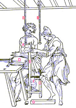 Arm Fracture Extension Machine by Hippocrates