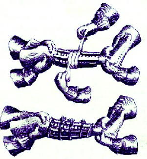 Splints Being Attached to a Leg