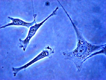 Fibroblasts in Mouse Embryos