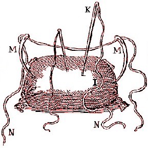 Intestinal Repair of Omentum