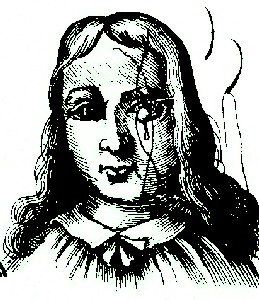 Eye Tumor Seton, Scultetus