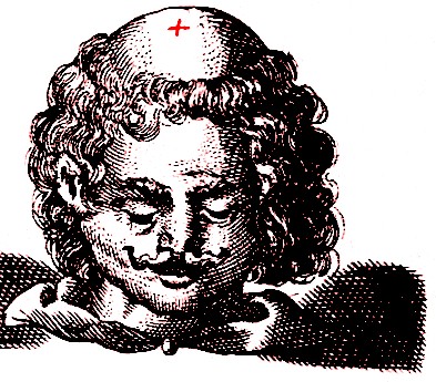 Head Fontanel Location, Scultetus