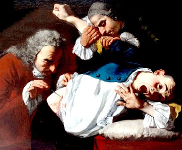 Probing a Wound to the Abdomen