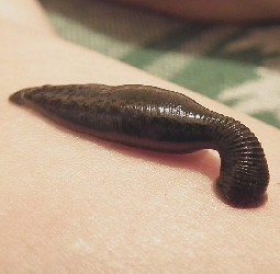 A leech at work