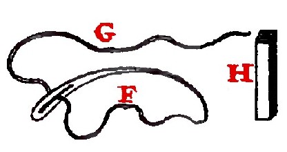 Needle Head Surgery Dionis