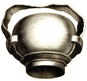 Head Cupping Glass, Purmann