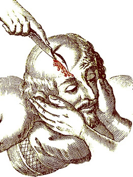 Surgeon Slicing Open the Scalp