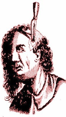 Removing Splinters With Forceps