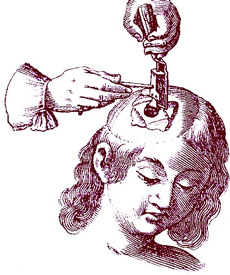 Turning Saw Use, Scultetus