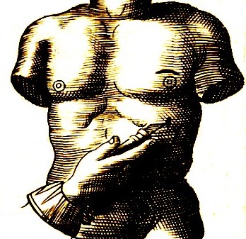 Second Incision in Chest