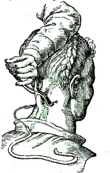 Preparing to Insert a Seton Needle