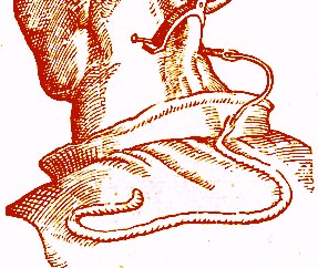 Seton Needle and Thread