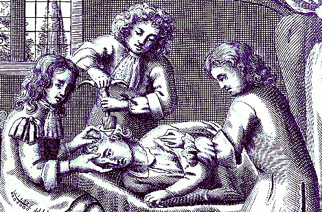 Trephining a Patient, John Brown